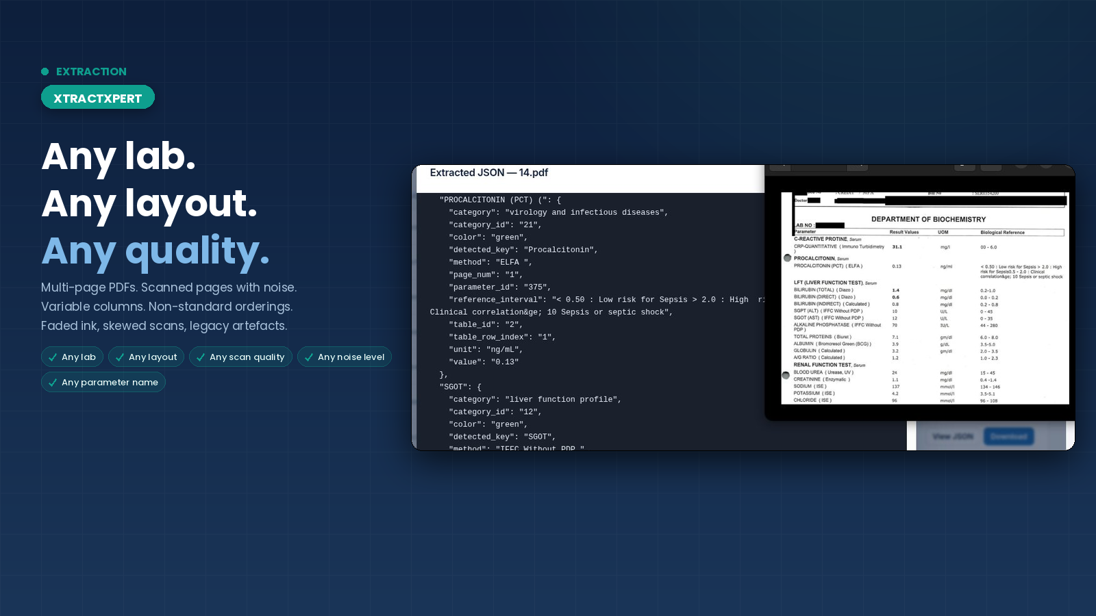XtractXpert — any lab, any layout, any quality